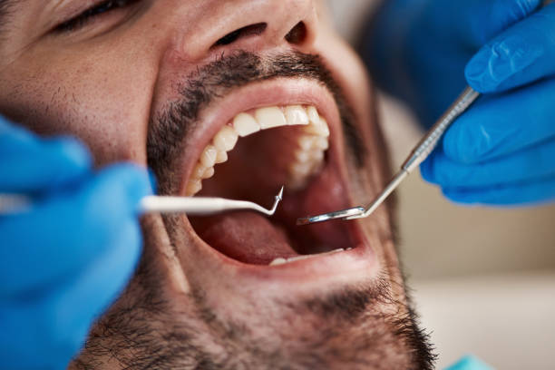 Best Emergency Tooth Extraction  in St Henry, OH