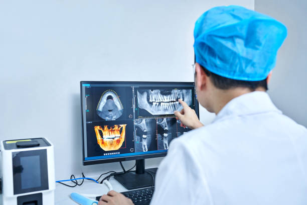 Best Chipped Tooth Repair Near Me  in St Henry, OH