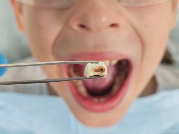 Best Dentist Open Late Near Me  in St Henry, OH